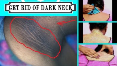 How to Get Rid of Dark Neck Fast and Easy|Natural Remedy| Brown skin around neck