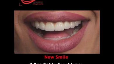 Le nouveau sourire de Maya Dbaich par New Smile Casablanca / Dr Amina EL OMRANI