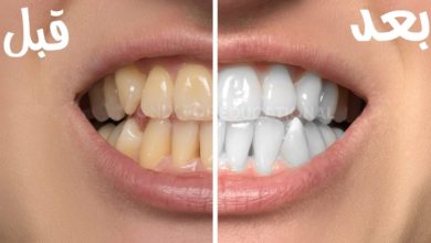 تبييض الأسنان بالفوتوشوب مع معاذ أشرف - Photoshop teeth whitening